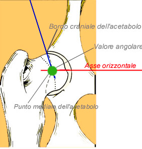Articolazione dell'anca