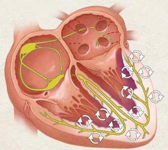 ischemia