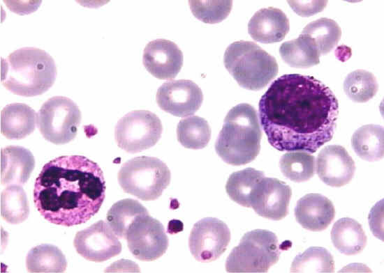 leucemia cane