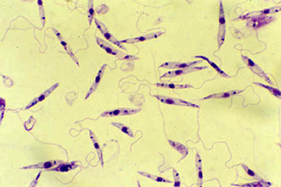 leishmania