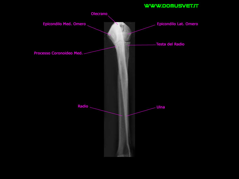 Radio e Ulna DV