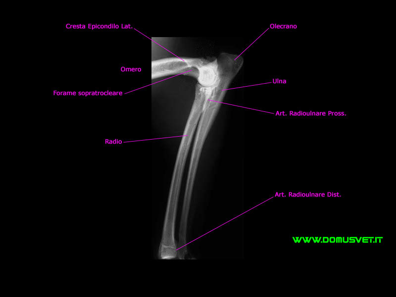 Radio e Ulna LL