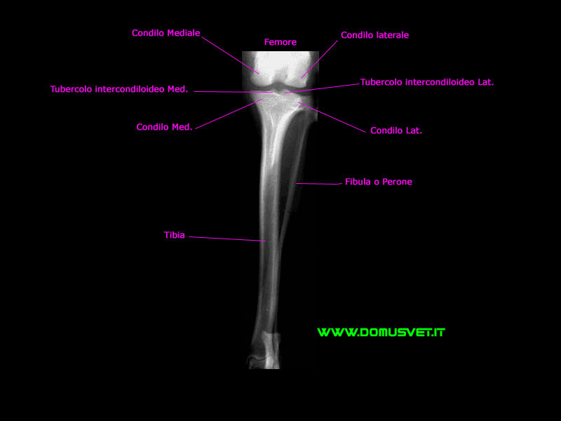 Tibia DV