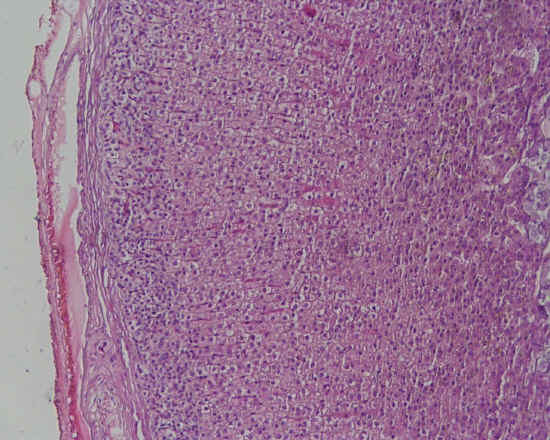 Ghiandola endocrina cordonale - surrene - 10x