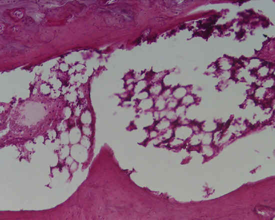 Tessuto osseo lamellare spugnoso - disco intervertebrale - 10x