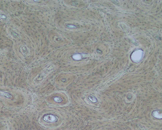 Tessuto osseo lamellare compatto - diafisi osso lungo - 10x