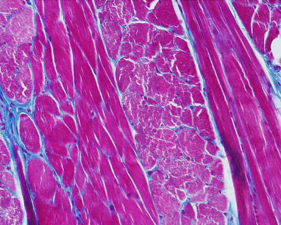 Tessuto muscolare scheletrico - lingua - 20x