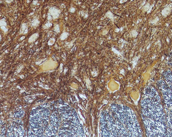 Neuroni - midollo spinale, impregnazione argentica - 20x