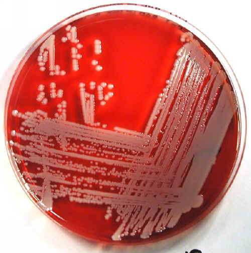 staphylococcus aureus