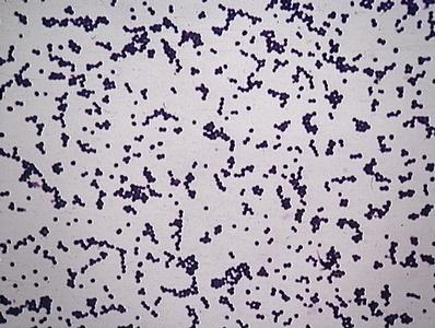 staphylococcus epidermidis