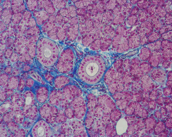 Ghiandola tubulo acinosa composta