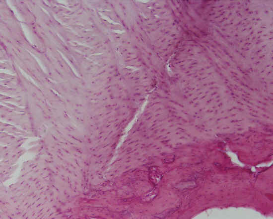 Cartilagine fibrosa - disco intervertebrale - 10x