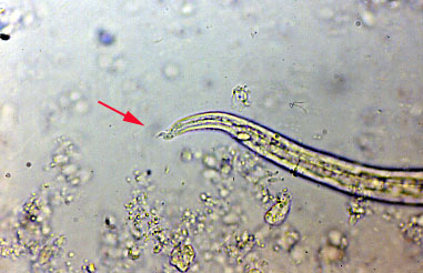 aelurostrongylus